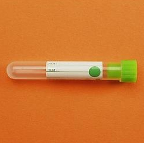 K2 EDTA'lı P.P Tüpler